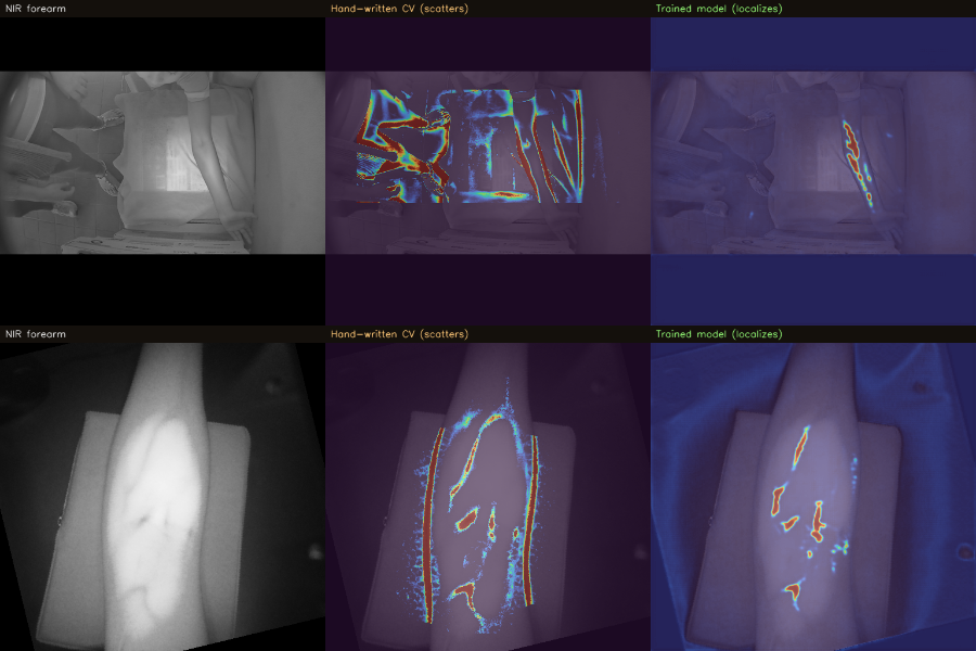 Three columns per row: NIR forearm, hand-written CV scattering everywhere, trained model localizing the veins
