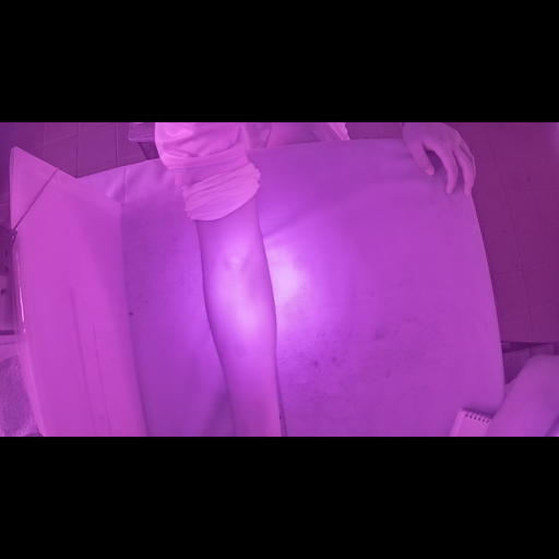NIR forearm sample
