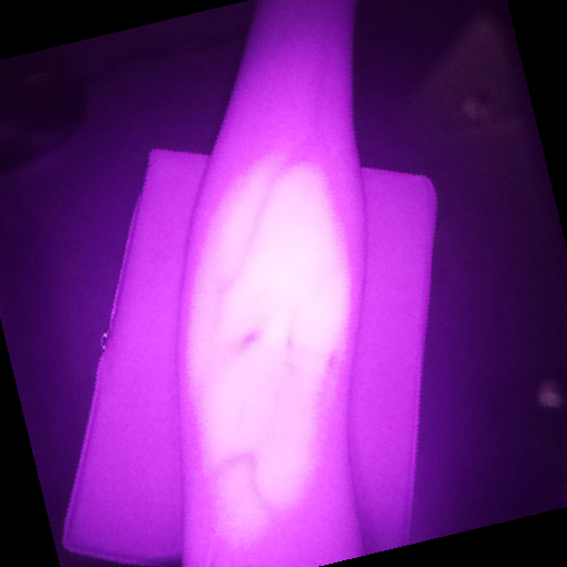 NIR forearm sample